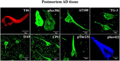 Human Dental Pulp Stem Cells Display a Potential for Modeling Alzheimer Disease-Related Tau Modifications